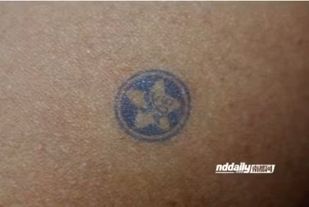 Dấu màu xanh được đóng lên mặt học sinh cá biệt hoặc phạm lỗi, một hình thức giáo dục phản cảm, phản tác dụng đang bị lên án