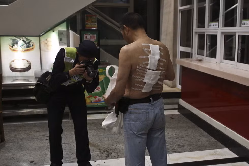 Pháo hoa bắn trúng lưng