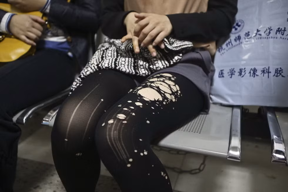 Cháy cả vớ
