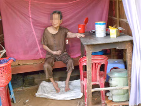 Dau long cu ba bi lao doi bai gio tro