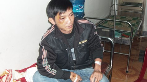 Ông Đào Công Thắng - Trạm trưởng trạm kiểm lâm trung tâm bị bắt vào tối ngày 11/12 sau khi đã được điều trị hồi phục vết thương tại Bệnh viên Đa khoa Cửa Đông