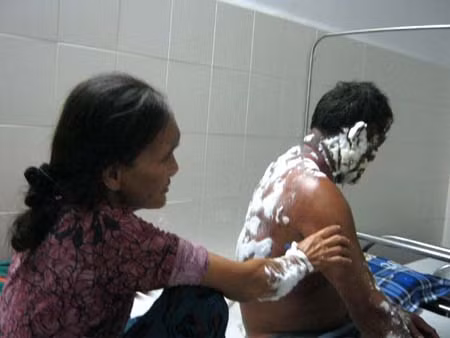 Vết bỏng độ 3: Đây là vết bỏng nghiêm trọng nhất rồi đây. Phần da bỏng có thể bị đen hoặc lại trắng bệch ra rất đáng sợ. Với vết bỏng độ này thì cần tức tốc đến bệnh viên ngay để xử lý vì nếu chậm trễ sẽ có thể dẫn đến tình trạng nhiễm trùng hết sức nguy hiểm. Xem thêm:26 loại thực phẩm giúp bạn ‘thanh lọc’ cơ thể