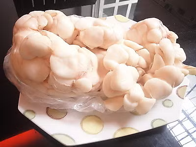 Dùng mỡ trăn hoặc dầu cá: Nhiều lọ mỡ trăn không được tiệt trùng nên hầu hết bị ôi thiu do nhiễm vi sinh vật. Do đó, vết bỏng bị nhiễm khuẩn rất nhanh. Còn dầu cá có mùi tanh, khi bôi lên sẽ bị hôi tanh và gọi ruồi đến. Xem thêm:26 loại thực phẩm giúp bạn ‘thanh lọc’ cơ thể
