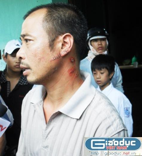 Anh Khuất Văn Phương, bác ruột của hai cháu bé bị hãm hại vẫn chưa hết bàng hoàng.