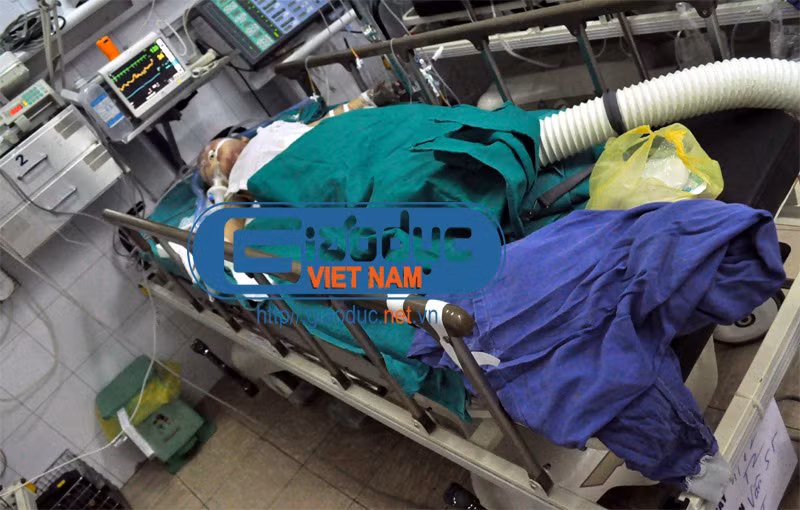 Hiện cháu Nguyễn Khánh Vân (SN 2006, ở Bắc Ninh) – nạn nhân duy nhất trong vụ nổ xe máy ở Bắc Ninh sáng ngày 1/12 còn sống vẫn phải thở bằng máy.