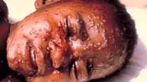 Nhiễm virus Ebola, tỷ lệ tử vong lên tới 90% ảnh 2 Nhiễm virus Ebola, tỷ lệ tử vong lên tới 90% ảnh 2