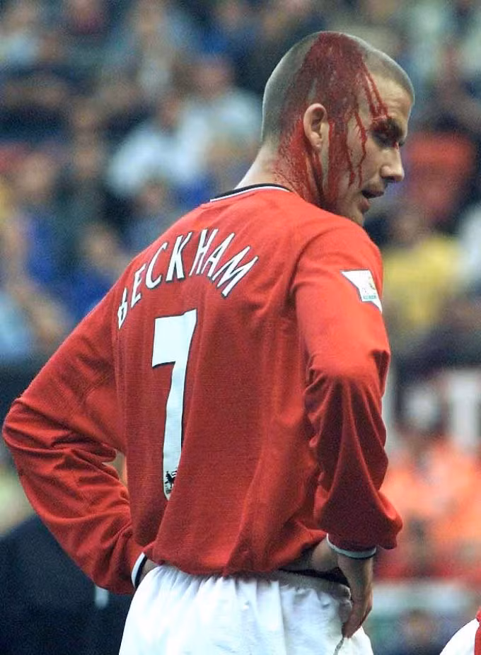 Beckham cũng từng phải đổ máu khi còn khoác áo MU.