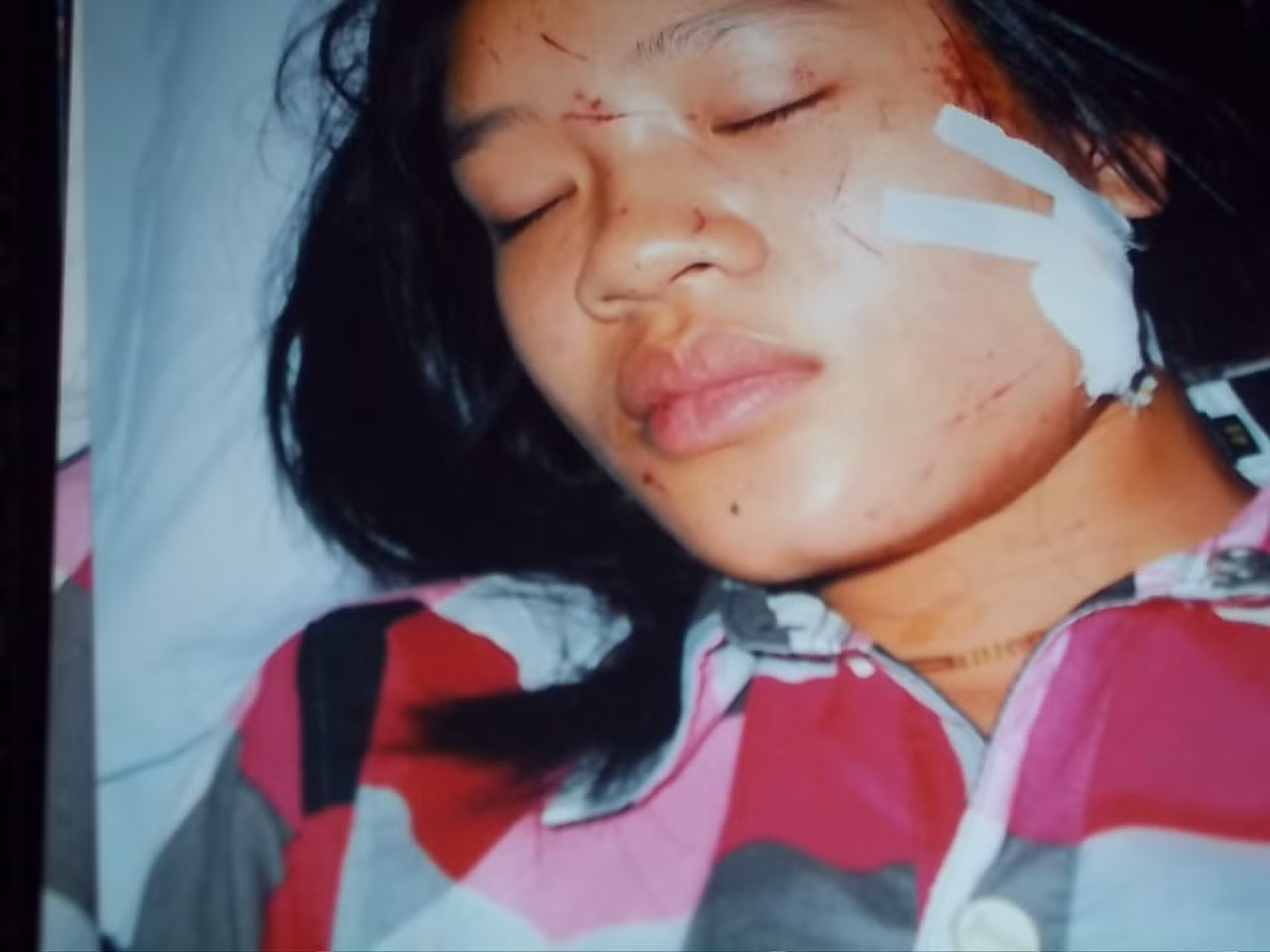 Hậu quả của vụ xô xát là Diễm Trinh bị đa chấn thương