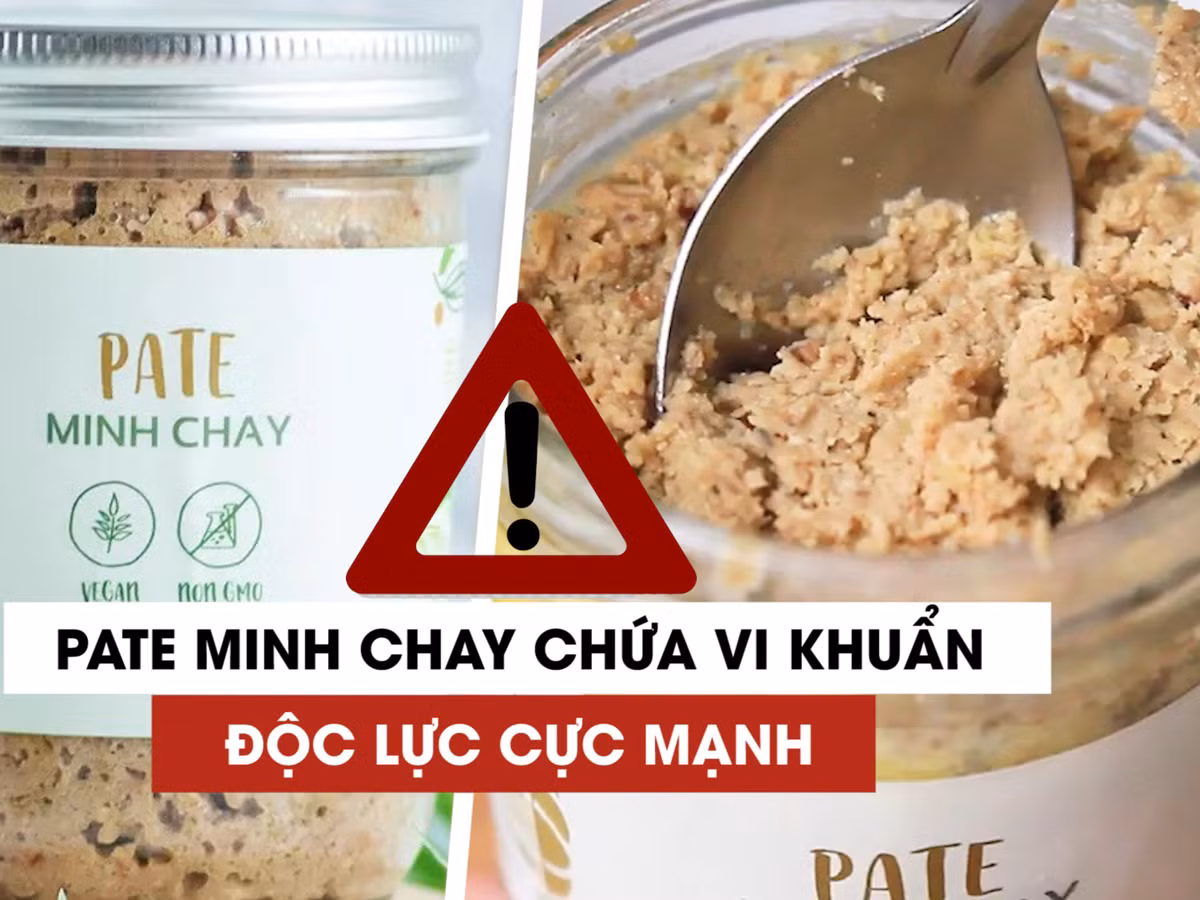 Đề cập đến ngộ độc thực phẩm do độc tố botulinum, bác sĩ Nguyễn Trung Nguyên, Giám đốc Trung tâm Chống độc (Bệnh viện Bạch Mai) cho biết, đây là loại ngộ độc kinh điển trong y văn. Ảnh minh họa: TD.