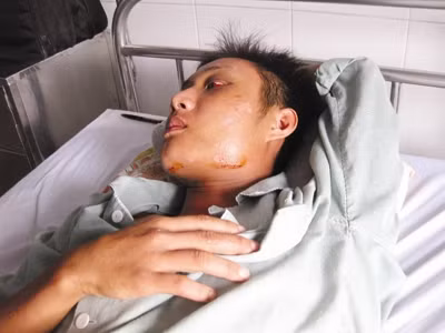 Nạn nhân một vụ thanh toán của giới giang hồ đất Mỏ. Nạn nhân một vụ thanh toán của giới giang hồ đất Mỏ.