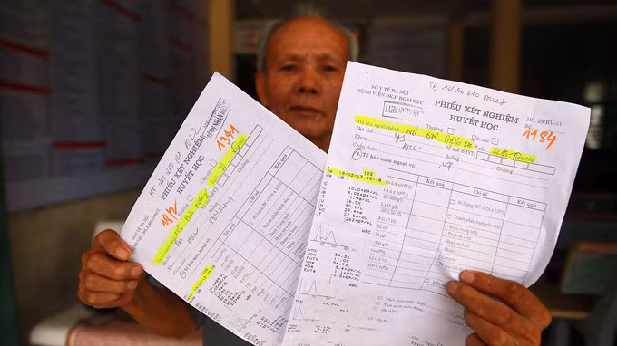 Phiếu xét nghiệm huyết học tại Bệnh viện Đa khoa Hoài Đức (Hà Nội) của hai người khác nhau nhưng các kết quả xét nghiệm lại hoàn toàn giống nhau - Ảnh: NGUYỄN KHÁNH Phiếu xét nghiệm huyết học tại Bệnh viện Đa khoa Hoài Đức (Hà Nội) của hai người khác nhau nhưng các kết quả xét nghiệm lại hoàn toàn giống nhau - Ảnh: NGUYỄN KHÁNH