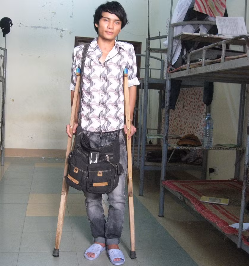 Em Nguyễn Hồng Hào với đôi nạng gỗ “vượt vũ môn” Em Nguyễn Hồng Hào với đôi nạng gỗ “vượt vũ môn”