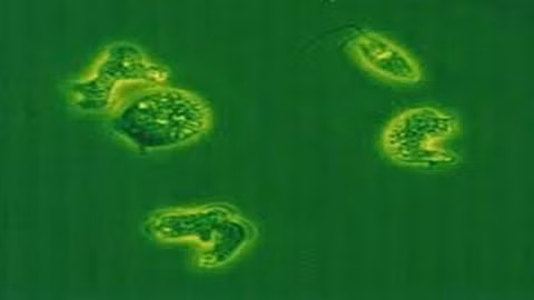 Amip Naegleria Fowler gây tử vong cho bệnh nhi 6 tuổi tại TP HCM (Ảnh do bác sỹ cung cấp)