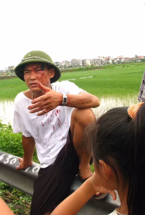 Không may, anh Nguyễn Văn Cường (trú tại xã Liên Bão, Tiên Du) đã bị một số đối tượng đi bên cạnh nhà sư đánh chảy máu đầu. Trong ảnh: Anh Cường đang ngồi kể cho bà con địa phương nghe chuyện bị nhóm đi bên cạnh nhà sư đánh chảy máu đầu.