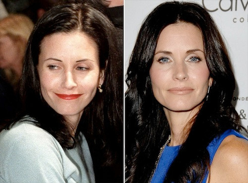 Courteney Cox hình như đã không thể "cười tươi" kể từ khi tiêm botox?