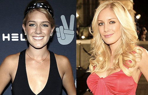 Người đẹp thẩm mỹ Heidi Montag ngày xưa có nụ cười tươi sáng hơn hiện tại rất nhiều.