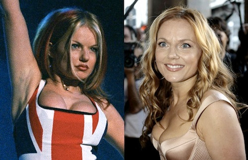 Cựu thành viên Spice Girls - Geri Halliwell đã từng thừa nhận là cô sử dụng botox. Và như chúng ta có thể thấy, tuy rằng cô đang cười nhưng đôi mắt lại trợn trừng lên nhìn rất... đáng sợ.