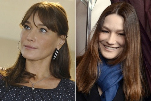 Cựu đệ nhất phu nhân tổng thống Pháp Carla Bruni cũng từng gây xôn xao với gương mặt biến dạng vì botox.